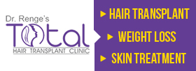 Hair Transplant